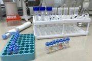 В Кабардино-Балкарском филиале лаборатории с начала года провели почти 100 исследований на антибиотики в пищевой продукции