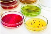 О выделении патогенных микроорганизмов из патологического материала