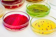 Питательные среды: важная деталь микробиологии